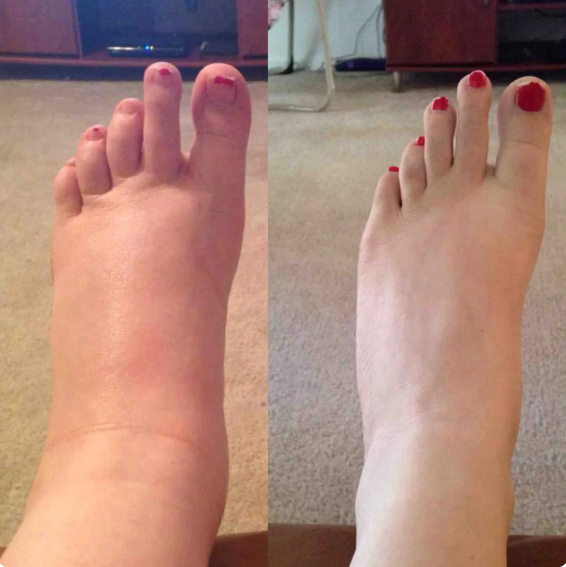 Lymphatic Drainage Drops